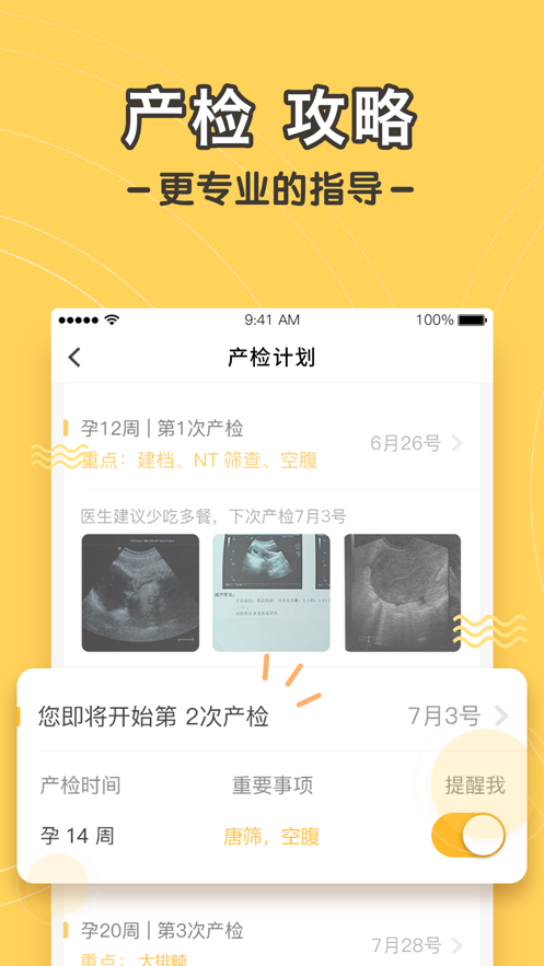 孕迹暖暖iphone版 V5.3.5