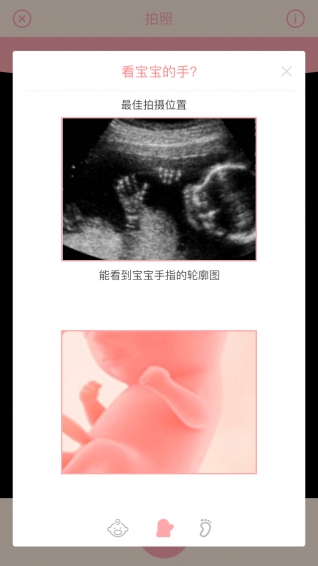 胎儿相机iphone版 V2.0